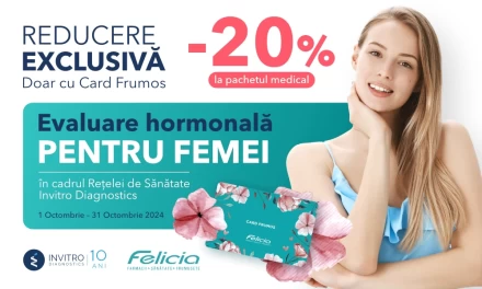 -20% REDUCERE pentru deținătorii “Card Frumos”!