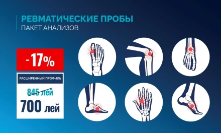 Ревматические пробы, расширенный профиль