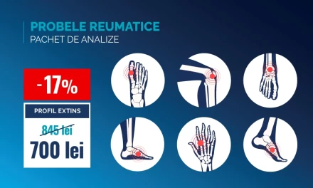 Probele reumatice, extins