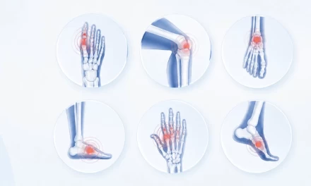 Basic Rheumatic Tests