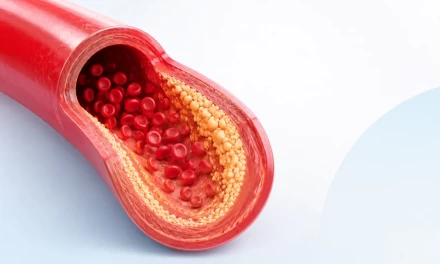 Basic Lipid Profile