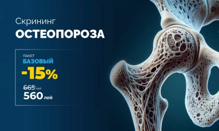 -15% на Базовый Скрининг Остеопороза 🦴