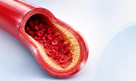Lipid Profile - basic