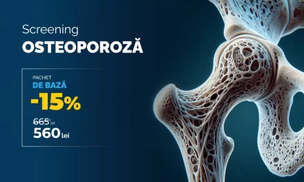 -15% la Screeningul Osteoporoză (De Bază) 🦴