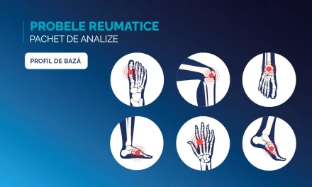 Probele Reumatice, de bază