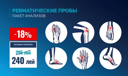 Ревматические пробы, базовый профиль