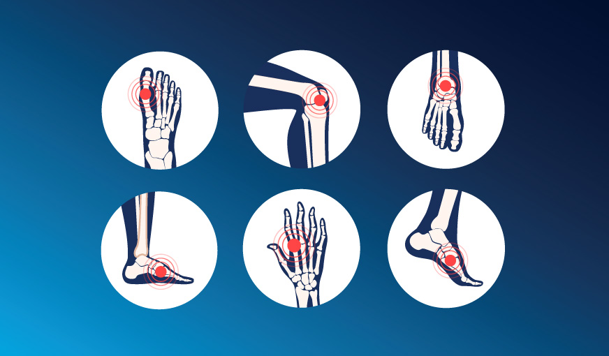 Rheumatology Profile, basic